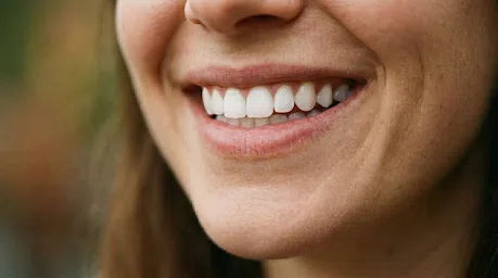 Al durabilidade com facetas de resina feitas com dentista em Ribeirão Preto.