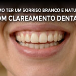 Clareamento Dental em Ribeirão Preto. Entenda como ter um sorriso branco e natural.