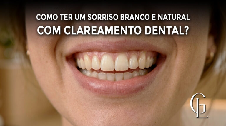 Clareamento Dental em Ribeirão Preto. Entenda como ter um sorriso branco e natural.