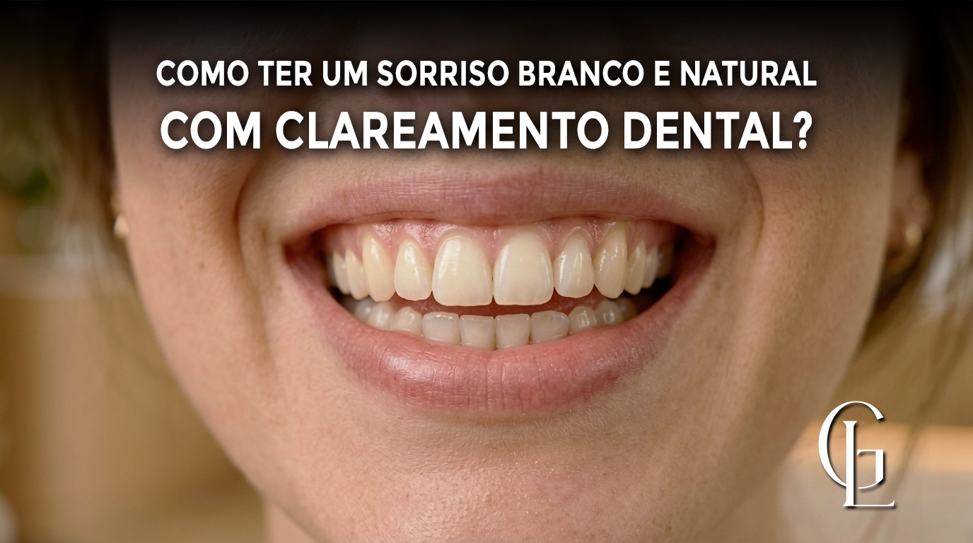 Clareamento Dental em Ribeirão Preto. Entenda como ter um sorriso branco e natural.