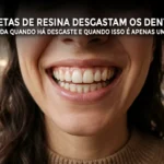 Facetas de Resina Desgastam os Dentes? Explicação do Dentista Gustavo Lizarelli sobre o assunto.