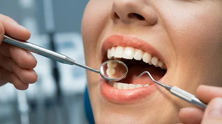 Limpeza profunda dental em Ribeirão Preto.